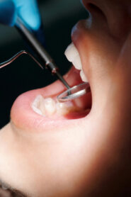 Sterling Dental Clinic – Kampala, Uganda